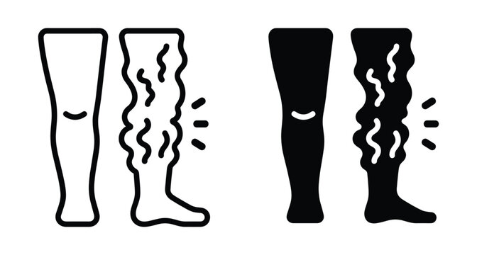 Varicose veins medical icon set showing healthy human leg and diseased leg with swollen vascular spider veins for healthcare diagnosis