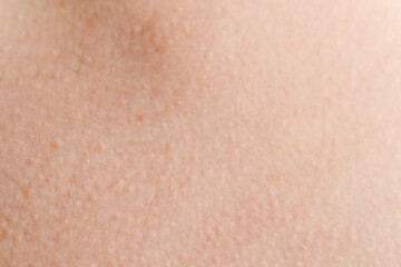 Fototapeta premium Texture of normal skin as background, closeup