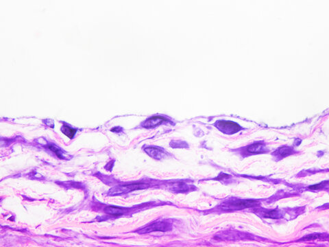 Simple squamous epithelium is a type of covering epithelium; those cells lining the inner surfaces of blood and lymphatic vessels are known as endothelial cells.Magnified 1000x
