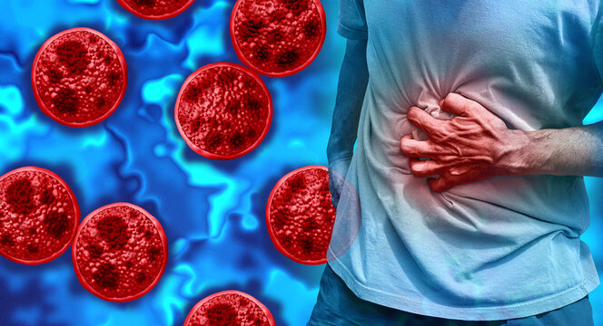 Cyclosporiasis disease outbreak as a foodborne parasitic illness caused by Cyclospora cayetanensis as an outbreak with contaminated food or water resulting in explosive diarrhea and digestive illness.