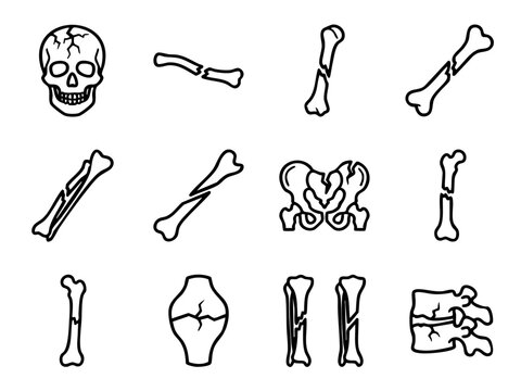 Bone fracture line icons set showing different types of broken bones and skeletal injuries.