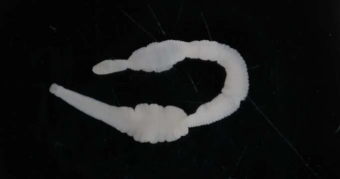 Cestode Larva (Cysticercus) and Strongyloides ratti Parasites in lab.