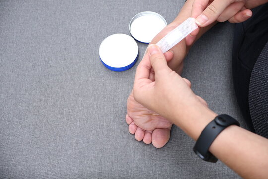 Close-up of heel skin: dry, irritated, and rough. Foot care, moisturizers, and a skin care routine for healthy feet at home. First aid for a callus on the foot, medical scenes
