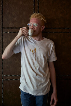 Albino man with a white T-Shirt stained with coffee drops