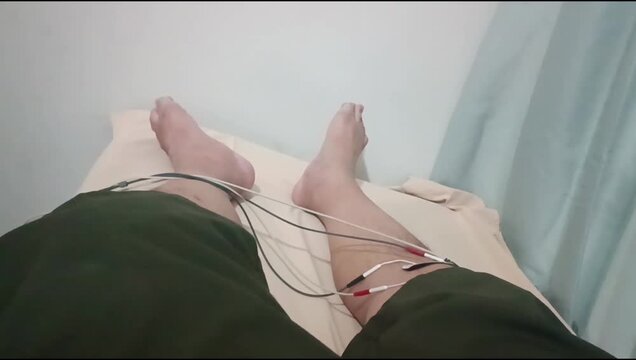 Person lying on a medical bed with EMG electrodes and wires attached to lower legs for nerve and muscle testing in a clinic.Osteoarthritis knee physiotherapy. 