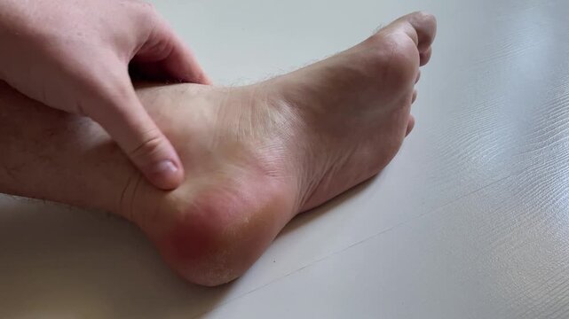 Man Massaging Painful Foot Heel and Arch Close Up