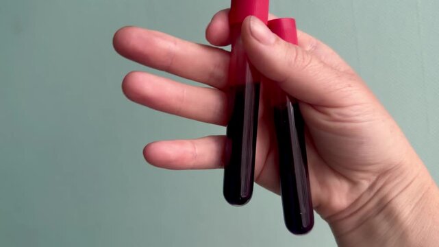 Close up of woman's hand holding blood sample test tubes in laboratory