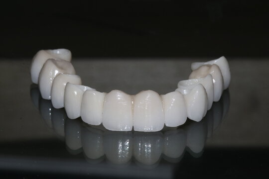 Full arch dental prosthesis designed for edentulous jaws in dental dentistry. Porcelain implant supported full arch prosthesis. All on four.