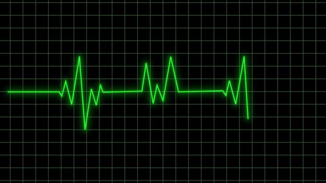 Green glowing neon heartbeat pulse animation on black screen background, ekg medical screen rhythm monitor, cardiogram line motion graphics loop for healthcare clinic presentation 4k video