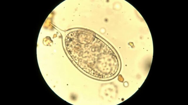 Microscopic View of a Single-Celled Organism in Motion