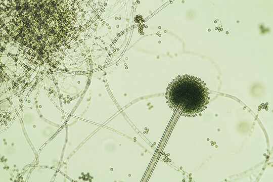 AI generated microscopic fungal hyphae spherical spore structures illustrating mycology microbiology laboratory research biological analysis scientific education