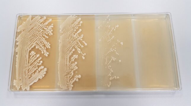 Rectangular Laboratory Agar Plate With Bacterial Colonies Showing Antibiotic Resistance