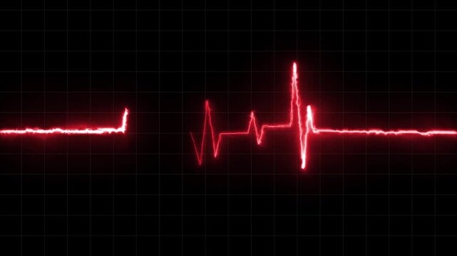 Heartbeat Monitor Animated Video, Heartbeat Medical Cardiogram Animation