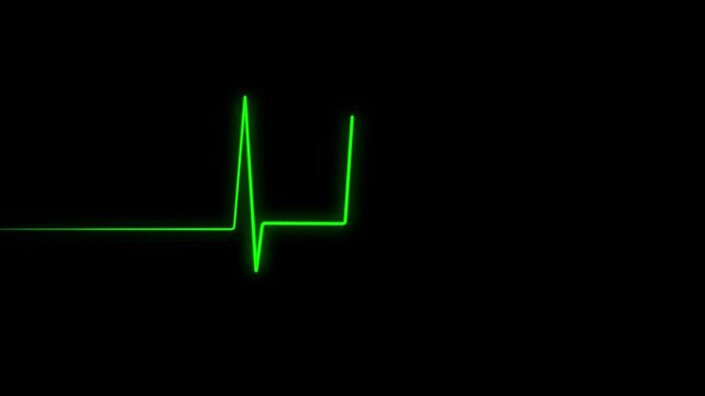 Heartbeat Monitor Animated Video, Heartbeat Medical Cardiogram Animation