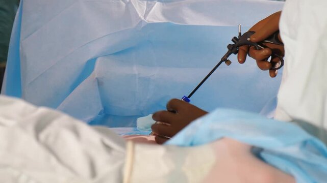 Surgeon hand inserting laparoscopic instrument through trocar port placed into patient's abdomen. Essential step in minimally invasive surgical procedure. Pro medical content. 4k video
