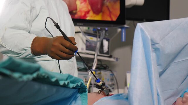 Surgeon hand holding laparoscopic instrument during surgery, with bright monitor displaying internal organs in background. Great for medical tech, surgical training, and healthcare marketing 4k video