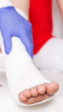 Medical professional hand wearing blue glove assisting person with injured lower leg application of white bandage or cast treatment for recovery vertical photo. Fracture of the tibia