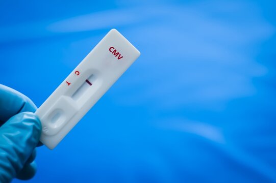 Blood sample of patient negative result for cytomegalovirus (CMV).