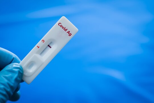The sample of patient negative result for covid-19 Ag.