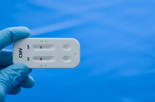 Blood sample of patient negative result for cytomegalovirus (CMV).