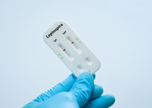 Blood  sample of patient negative result for leptospira.