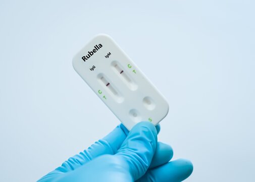 Blood  sample of patient negative result for rubella virus.