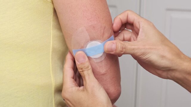 Man applying protective patch over glucose monitoring device on woman arm