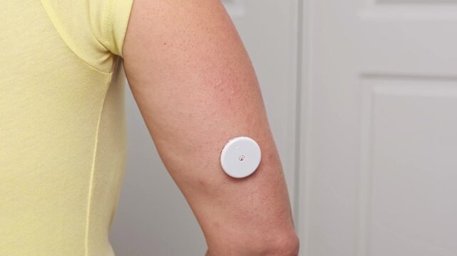 Caucasian woman applying continuous glucose monitor on upper arm at home