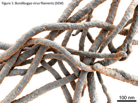 Bundibugyo virus filaments visualised with scanning electron microscopy technology.
