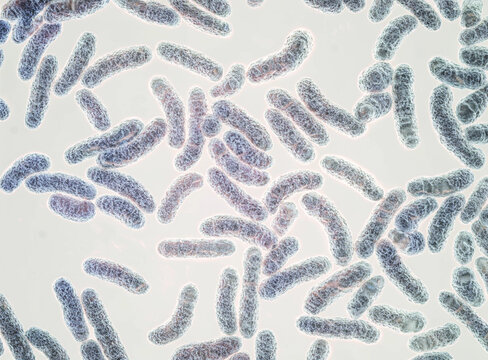 Microscopic View of Mycobacteria Bacteria Under Laboratory Microscope