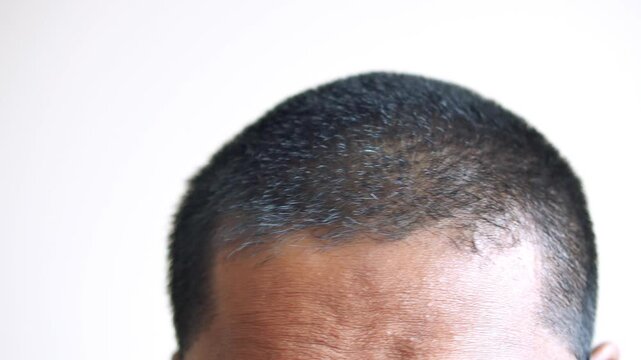 Close up footage of man's short haircut showing thinning hair and receding hairline