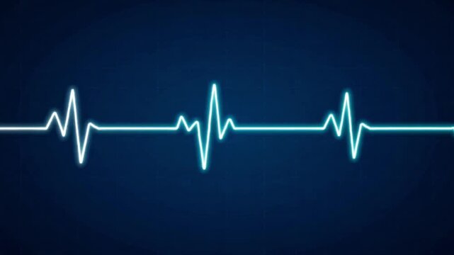 heart beat cardiogram