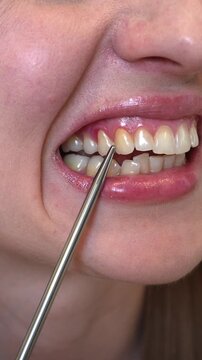 Young woman showing an inflamed gum during a dental health concept.