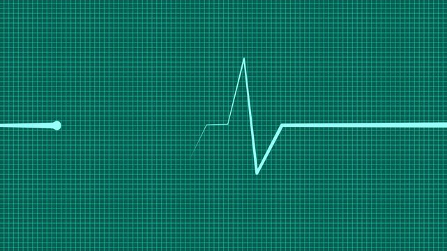 Heartbeat line wave signal showing a medical pulse pattern isolated animation
