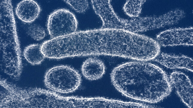 Microscopic view of Nipah virus particles under electron microscope zoonotic pathogen paramyxoviridae