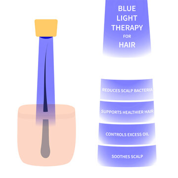Blue light therapy scalp diagram focused on follicles and hair thinning vector illustration.