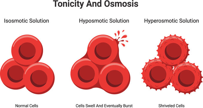Tonicity and Osmosis Medical Vector Illustration Comparing Isotonic Hypotonic and Hypertonic Solutions with Red Blood Cell Changes Educational Biology Diagram