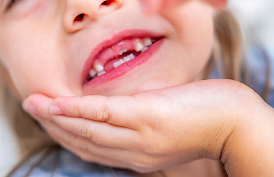 happy positive funny toothless 6-year-old girl, Close-up smiling child's face, showcasing missing baby teeth and joyful expression, waiting for toothfairy, innocence, growth, and childhood milestones
