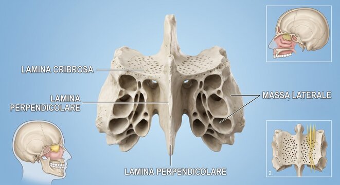 Etmoide