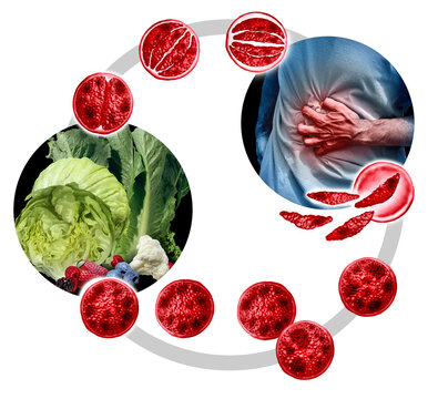 Cyclosporiasis Food Poisoning  Cyclospora Outbreak and Contamination on Produce as an outbreak and spread as a foodborne parasitic disease caused by cayetanensis through contaminated food as fruits an