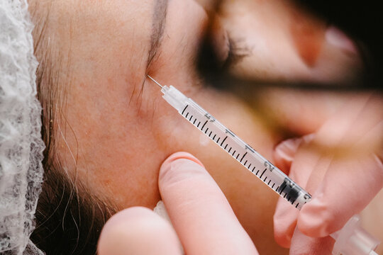 Close up com jeringa aplicando botox 