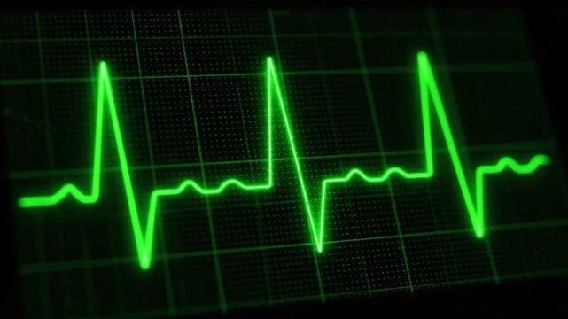 Bright green heartbeat monitor display with rhythmic ECG wave patterns on a dark grid background.