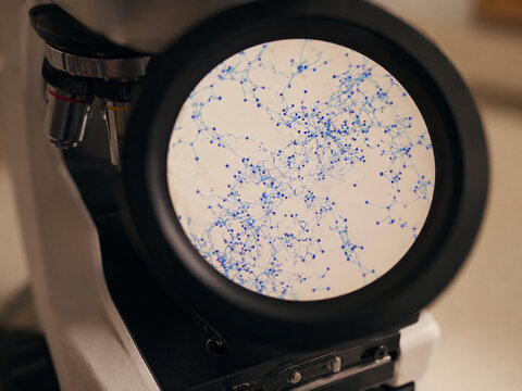 AI generated microscopic fungal cell structure blue stained hyphae spores detailed laboratory specimen ideal for microbiology education medical research science backgrounds