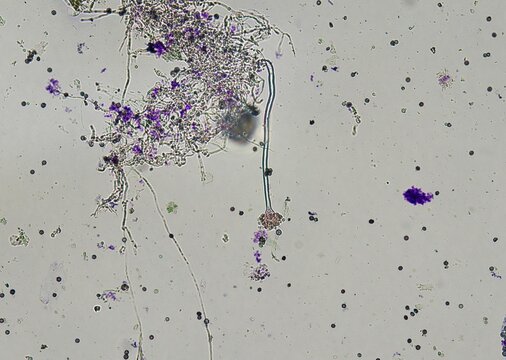 soil microorganisms under a microscope including amoeba, flagellates, nematodes, fungi, bacteria