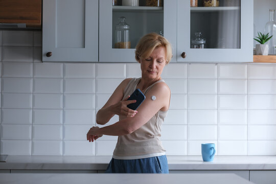 Mature woman  measuring glucose level, using mobile application on smartphone to receive continuous glucose monitor (CGM) data. Living with diabetes, modern diabetes devices