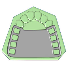 Single Broad Posterior Palatal Plate Major Connector Illustration © Bhuvana
