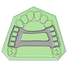 Anteroposterior Palatal Strap Major Connector Illustration © Bhuvana