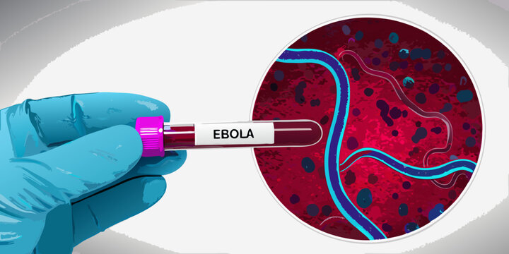 Ebola Virus Visualization With Hand Holding Test Tube Vector Illustration