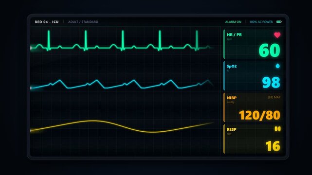 Digital Medical Monitor Displaying Patient Vital Signs and ECG Waveforms for Healthcare and ICU Contexts