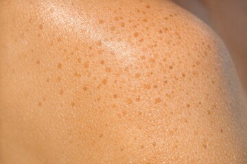 Fototapeta premium Close-up of human skin featuring freckles, great for beauty or health-related uses